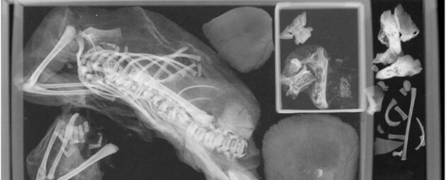 Девушка-подросток умерла в родах