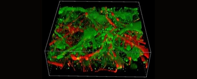 Вчені надрукували мозкову тканину на 3D-принтері