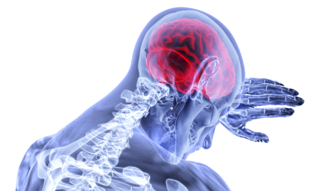 Sinais de acidente vascular cerebral: como reconhecer uma condição perigosa