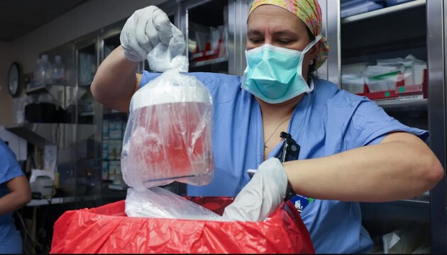 Людині пересадили нирку свині