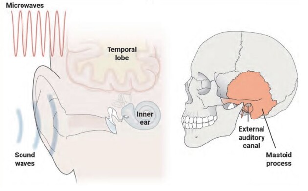 Вплив електромагнітних імпульсів на мозок