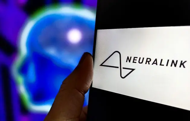 Neuralink рассказала о первых 100 днях использования импланта