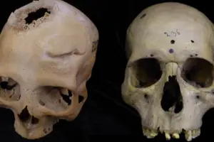 У черепі зі Стародавнього Єгипту виявили сліди складної хірургічної операції