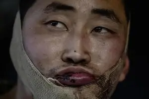 Южная Корея проконсультируется с Украиной о передаче пленных бойцов КНДР