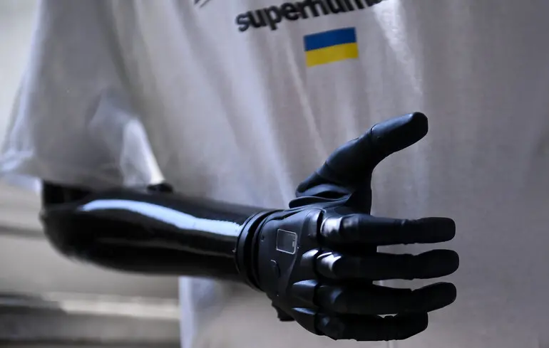 Нейроінженерія в Україні: дослідження, що змінюють медицину