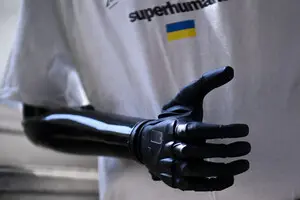 Нейроинженерия в Украине: исследования, изменяющие медицину