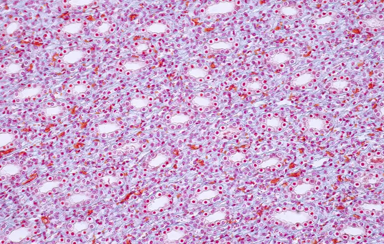 Клетки человеческой почки (фото иллюстративное)