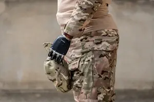 Воєнна соціалка: протезування за рахунок держави