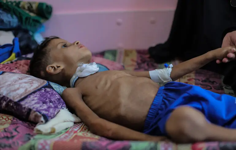 В ООН сообщили, сколько детей получили инвалидность с начала войны в Газе — The Guardian