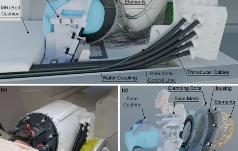 Схема работы ультразвукового "шлема",