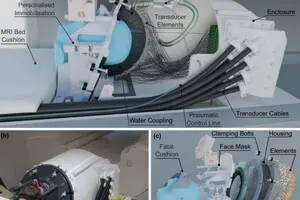 Вчені розробили пристрій, який може лікувати неврологічні захворювання без хірургічних втручань