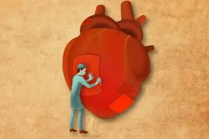 Сердце и система. Почему медицинская реформа буксует и что может ее спасти