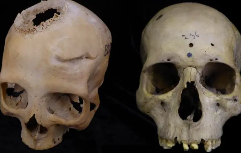 Фото иллюстративное.