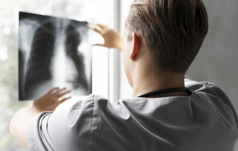 Туберкульоз: хто може безкоштовно отримати профілактичне лікування