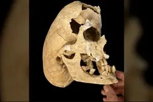 З рідкісним генетичним захворюванням: учені знайшли незвичайний скелет середньовічного лицаря