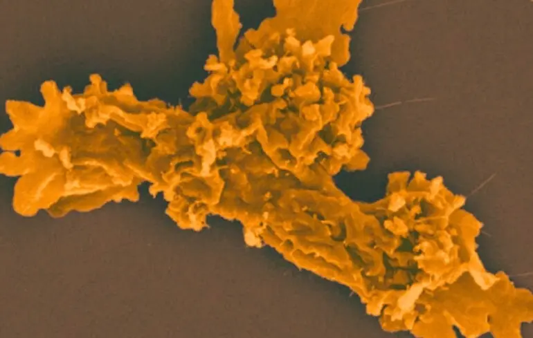 Клітина амебоїдної форми.