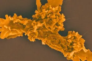 “Вогняна амеба” встановила рекорд термостійкості: росте за температури 63°C