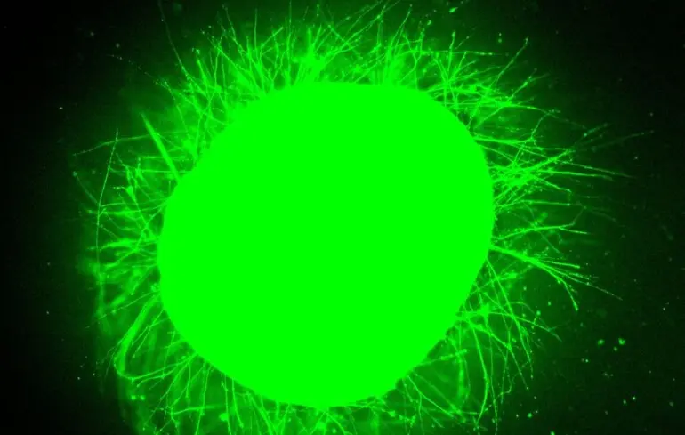 Учені виростили в лабораторії спинний мозок і змусили його зцілитися після травми