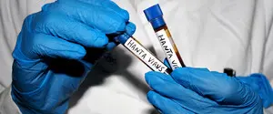 Вспышки хантавируса могут участиться: ученые объяснили, почему