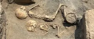 На черепе 5-летнего ребенка: ученые нашли следы древнейшей операции в Центральной Азии