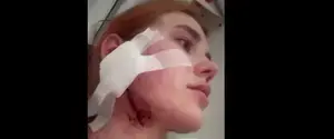 Во Вроцлаве поляки напали на украинцев из-за украинского акцента. В генконсульстве отреагировали
