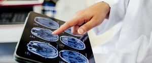 Учёные восстановили работу нейронов при болезни Альцгеймера: эксперименты показали неожиданные результаты