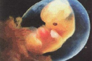 Мировой рекорд: в США родился ребенок из 20-летнего эмбриона