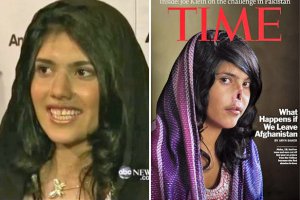 Американські хірурги повернули обличчя покаліченій «талібами» афганській дівчині