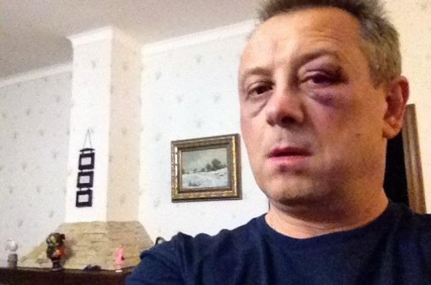 Народного депутата от "УДАРа" избили возле супермаркета под Киевом