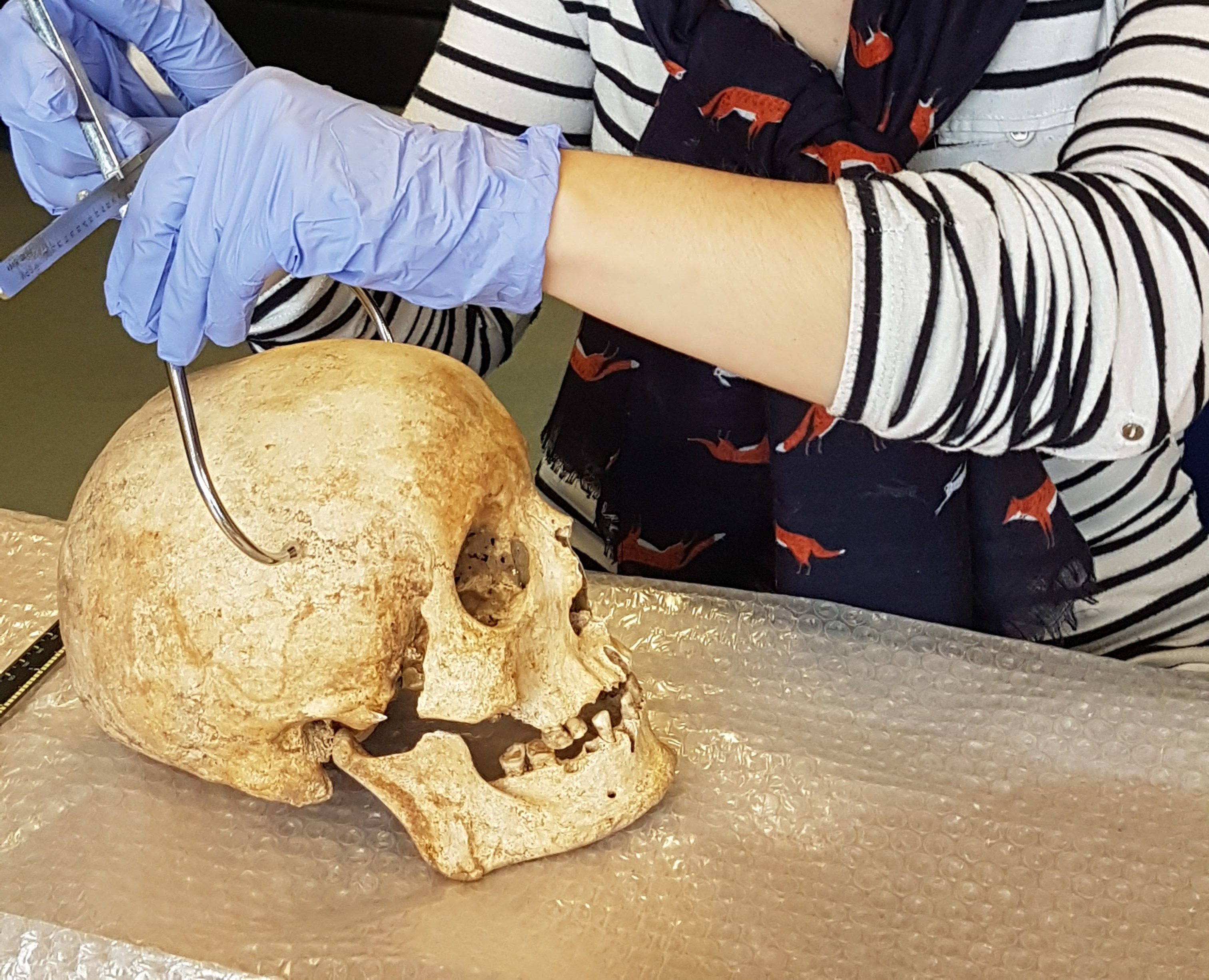 Ученые реконструировали лицо мужчины по его черепу