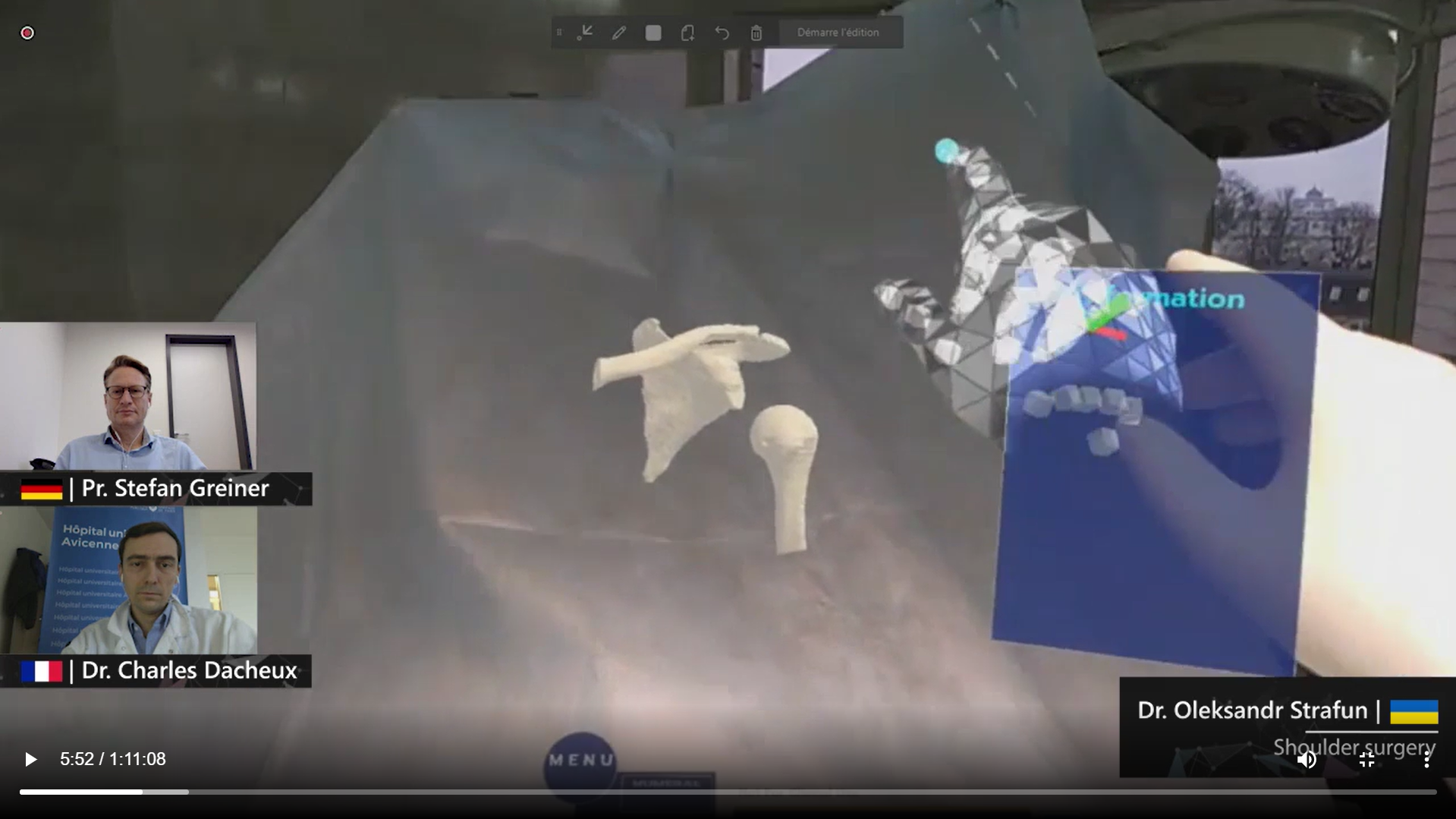 Фото 24H Holographic Surgery Фото 24H Holographic Surgery