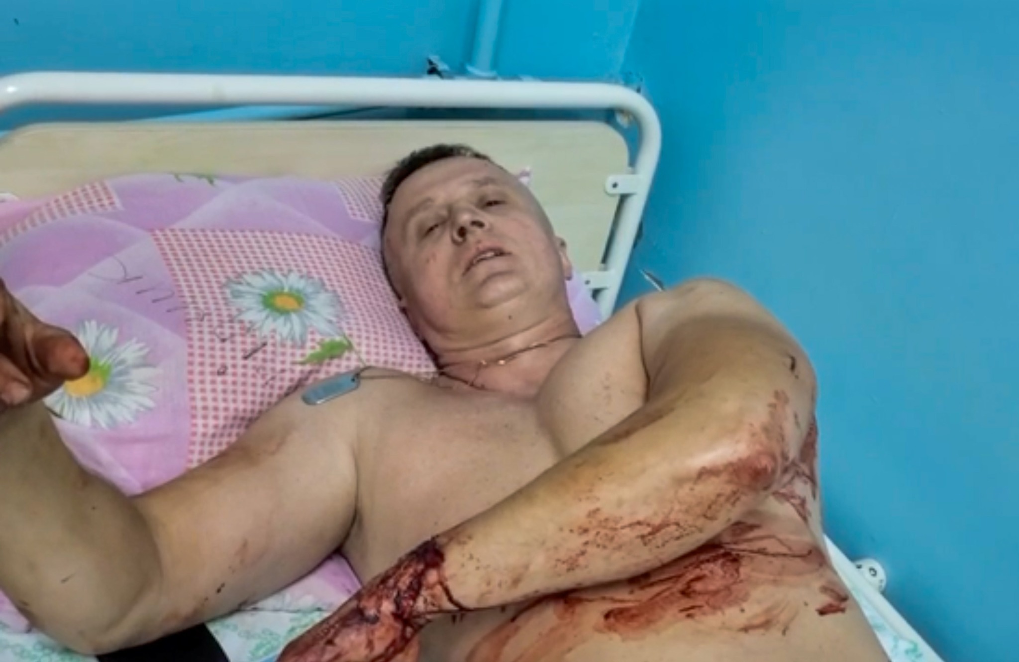 Раненный в Покровске полицейский Владимир – герой фильма «20 дней в Мариуполе»