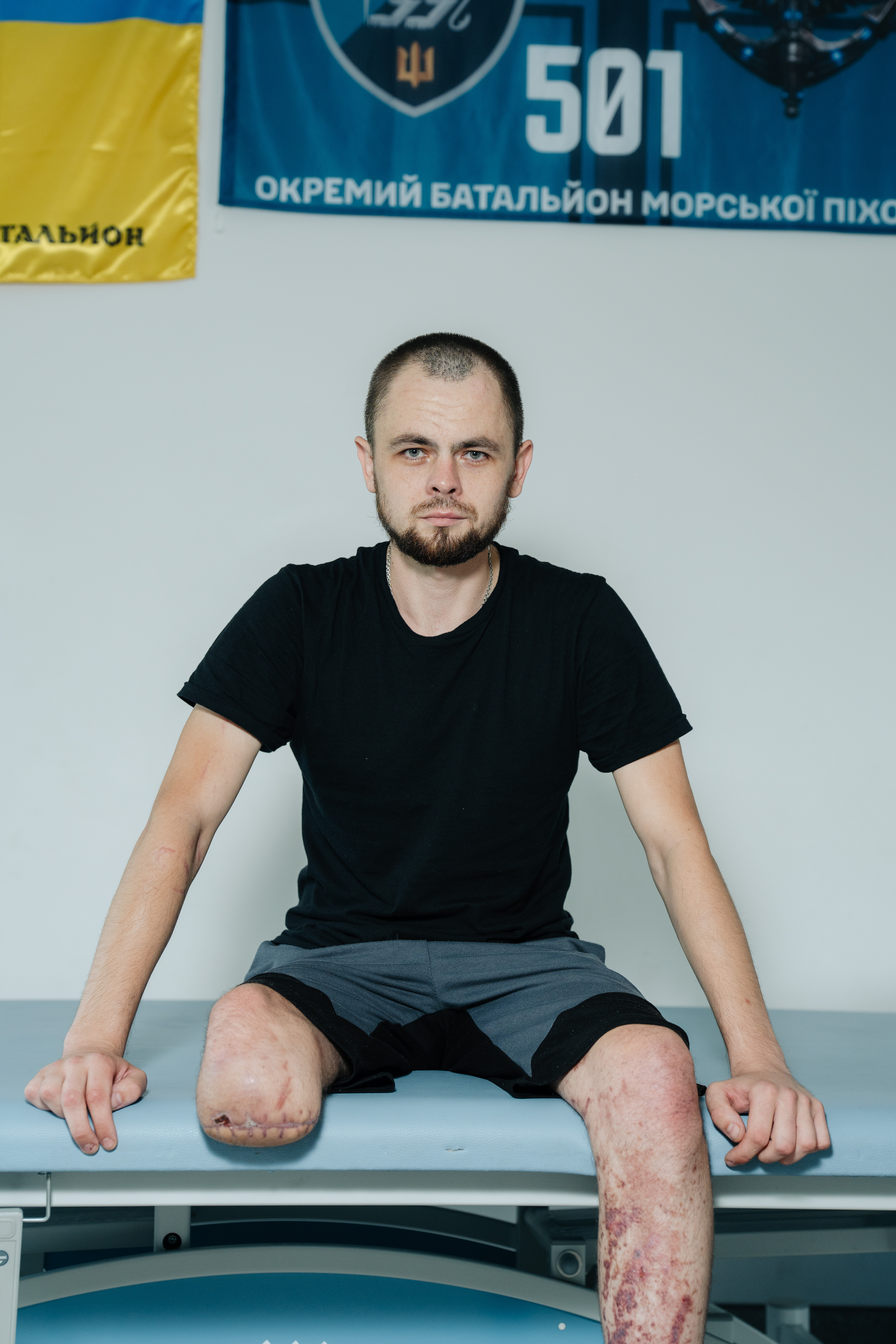 Українська Одіссея: що для поранених військових означає повернутися додому