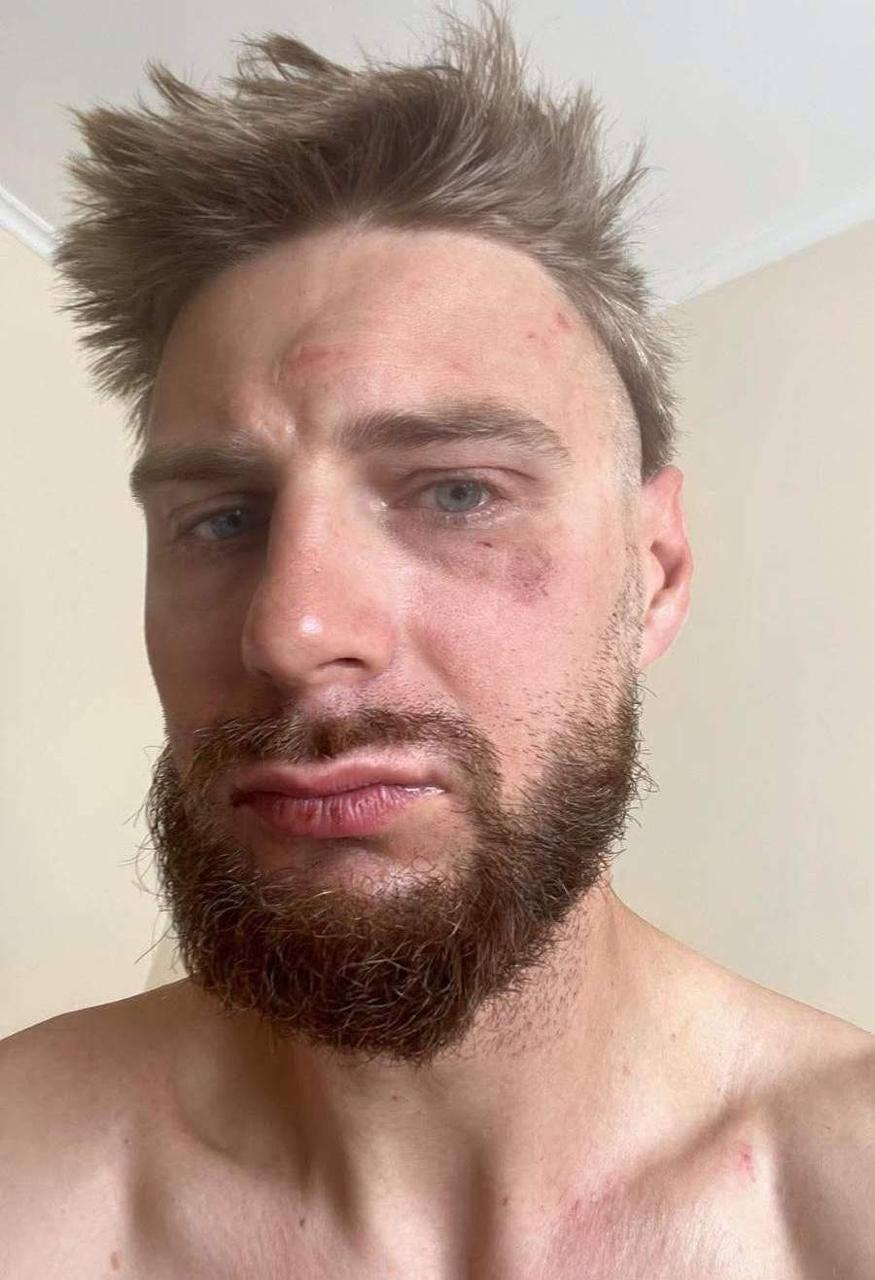 У Чехії поляки побили свого земляка, прийнявши його за українця