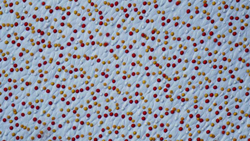 Второе место. Сетчатка глаза черепахи Chrysemys picta