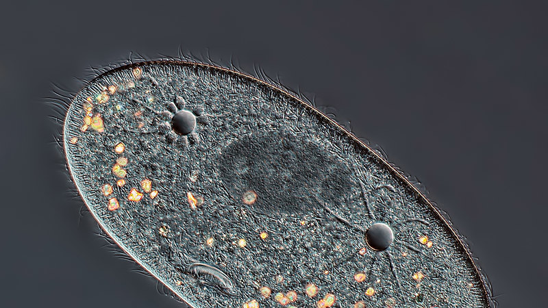 Четвертое место. Инфузория Paramecium. Хорошо видны ядро и вакуоли