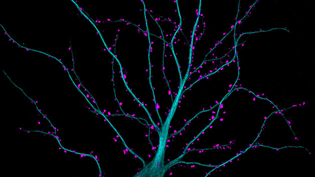 Пятое место. Синапсы в нейроне гиппокампа