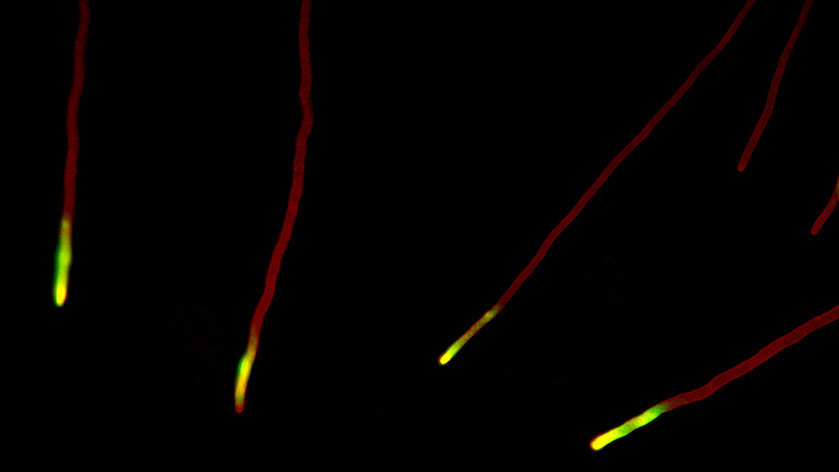 Грибок Podospora anserina