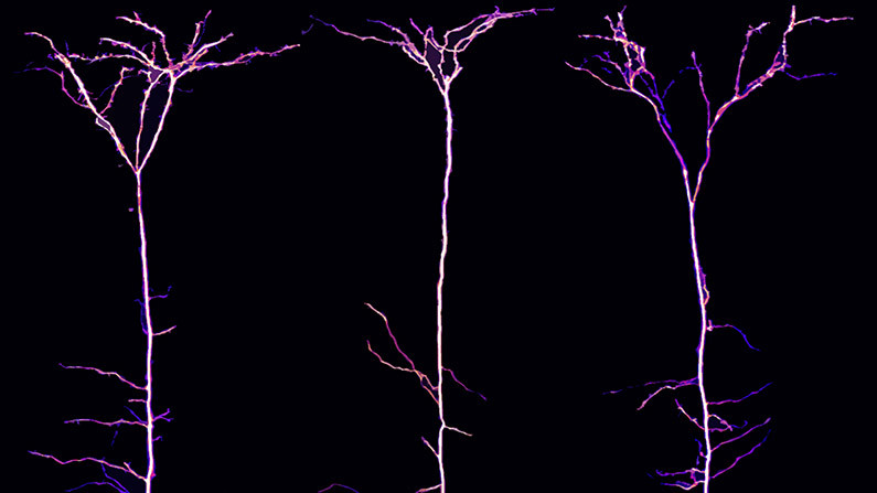 Пирамидные нейроны в зрительной коре мозга мыши. Внизу справа виден электрод-капилляр