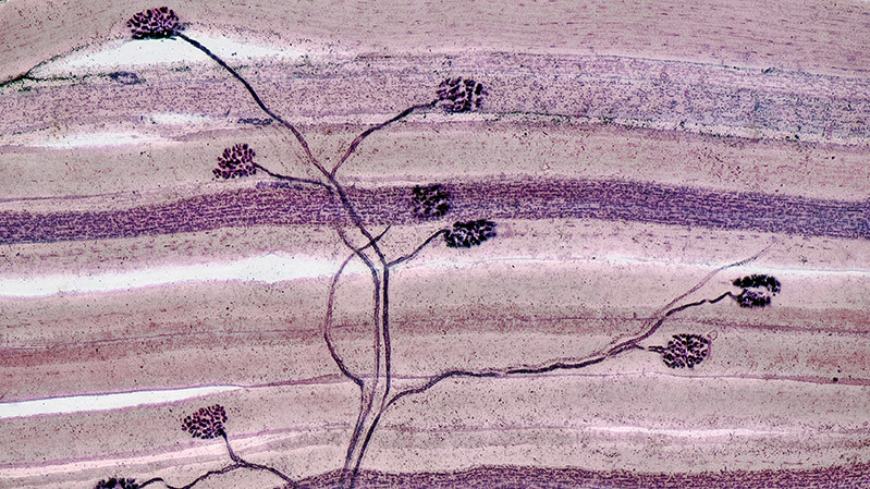 Срез мышцы с нервными окончаниями