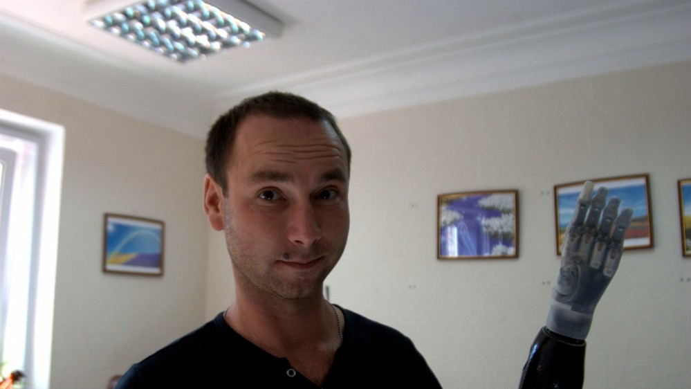 Щоб навчиться керувати протезом потрібні спеціальні тренування