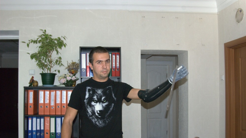 Щоб навчиться керувати протезом потрібні спеціальні тренування