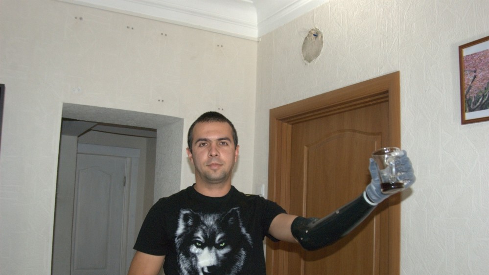 Щоб навчиться керувати протезом потрібні спеціальні тренування