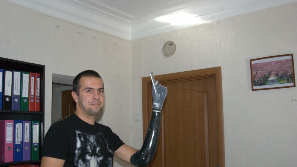 Щоб навчиться керувати протезом потрібні спеціальні тренування