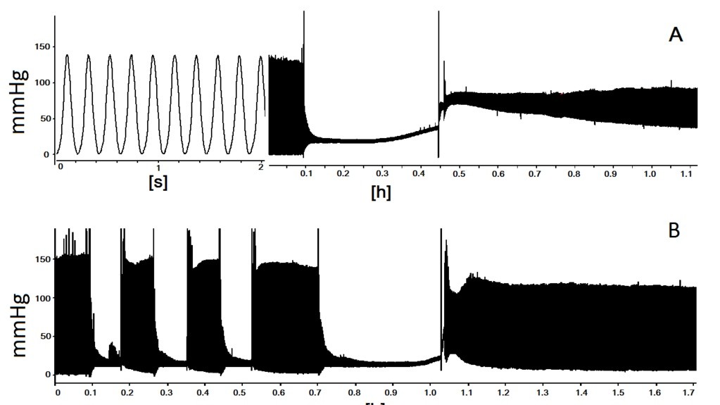 Коллажи. Ишемическое прекондиционирование изолированного сердца крысы. Автор Goshovska