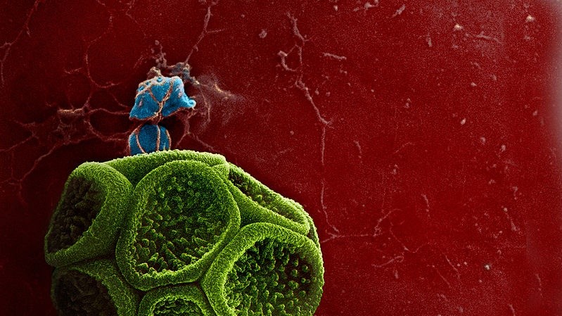 Микроскопия. Кластеры спор, образовавшихся в спорангии миксомицета Reticularia olivacea из лесов на востоке Украины. Автор Дмитрий Леонтьев