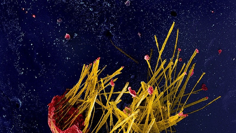 Микроскопия. Плодовые тела миксомицета Alwisia lloydiae с острова Тасмания. Автор Дмитрий Леонтьев