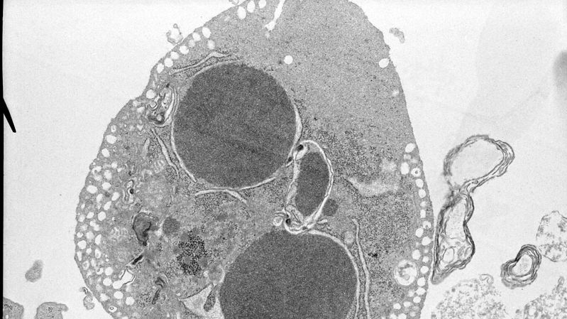 Микроскопия. Апоптоз. Ультраструктура неонатального кардиомиоцита в культуре после аноксии-реоксигенации. Автор Ltumanovskaya