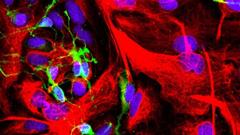 Микроскопия. Конфокальная микрофотография NG-2-положительных клеток-предшественников олигодендроцитов (зеленый) и GFAP-положительных астроцитов (красный). Автор Tsoleg