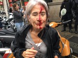 Більше тисячі людей отримали поранення в ході голосування за відділення Каталонії від Іспанії.